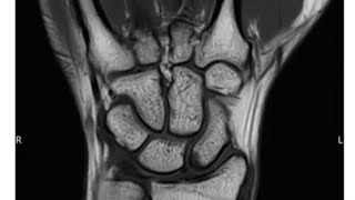 MSK ANATOMY FOR FRCR 1 [upl. by Ydac]