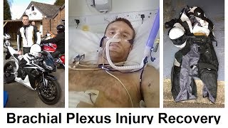 Brachial Plexus Injury Recovery [upl. by Howe460]