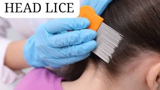 All about lice infestation and Treatment Dr Abdul Majeed [upl. by Mcmullan972]