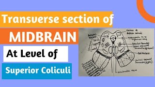 Midbrain transverse section at superior colliculus drurmila3614 [upl. by Llemaj]