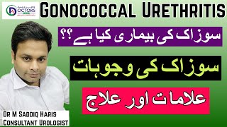 Gonorrhea Gonorrhea Treatment  Gonorrhea Meaning  SOZAK  سوزاک کیا ہے؟  سوزاک کا علاج [upl. by Ayatahs]