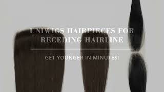 Best Solutions to Receding Hairlines Stay tuned [upl. by Ynotna416]