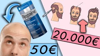 STOP HAIR LOSS with these TOP 10 Treatments Anti hair Loss [upl. by Teresina]