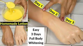 I applied👆this Skin Whitening Lotion On Dark HandsIn 3 Days Dark Dull Skin Got Fair White amp Glowing [upl. by Enirahtak116]