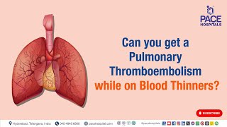 Can you get Pulmonary Thromboembolism while on Blood Thinners [upl. by Alios589]