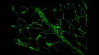 GFP  Endoplasmic reticulum in a plant cell [upl. by Angelis]