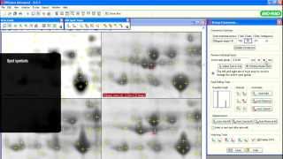 PDQuest™ Software Tutorials — Editing Protein Spot Analysis [upl. by Lavern]