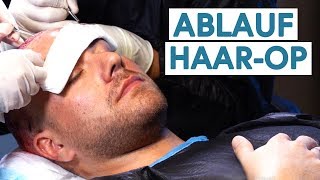 Der Komplette Ablauf einer Haartransplantation OP Türkei [upl. by Thirza]