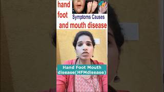 Hand Foot Mouth diseaseHFMdiseasetrending shorts hfmd handfootmouthdisease tomatoflu telugu [upl. by Tillman521]