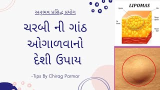 ચરબી ની ગાંઠ નો ઈલાજ  ચરબી ની ગાંઠ  ચરબીની ગાંઠ ઓગાળવાનો દેશી ઉપાય [upl. by Nulubez521]