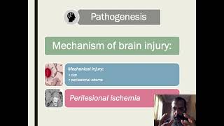 intracerebral hemorrhage [upl. by Alakcim109]