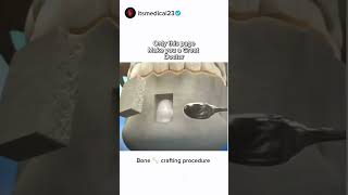 Bone crafting procedure mbbs doctor surgeon [upl. by Trevor746]