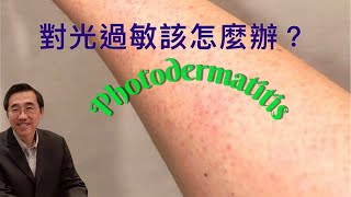 《對光過敏該怎麼辦？》｜Photodermatitis [upl. by Aicinat]