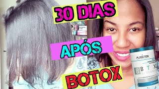 1 MÊS APÓS BOTOX DA PLANCTON  MUDOU ALGO [upl. by Dyoll]