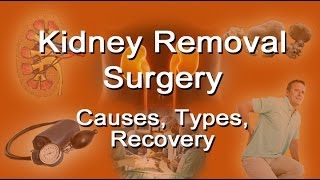 Kidney Removal Surgery  Causes Types Recovery [upl. by Durgy]