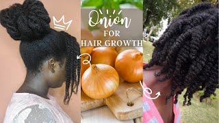 🤯Onion Juice for FAST HAIR GROWTH‼️ naturalhair gargeoushair [upl. by Irreg]