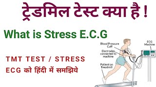 TREDMIILL TEST  TMT TEST IN HINDI  STRESS TEST  STRESS ECG [upl. by Acinoreb]