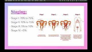 CA Endometrium [upl. by Irina]