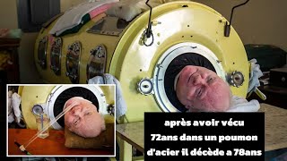 🚨🚨 Paul Alexander est décédé  le dernier survivant dun poumon en acier [upl. by Affrica148]