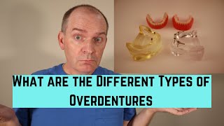 What are the different types of overdentures [upl. by Biddick990]