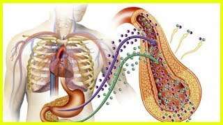 Diabetes Typ 2 – Ursachen [upl. by Euqinobe]