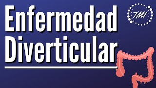 Enfermedad Diverticular Explicada Claramente [upl. by Gnot124]