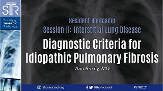 Diagnostic Criteria for Idiopathic Pulmonary Fibrosis [upl. by Forkey765]