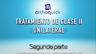 TRATAMIENTO DE CLASE II UNILATERAL SEGUNDA PARTE [upl. by Landahl120]