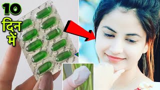 Evion 400  Vitamin E Skin Treatment Get BeautifulSpotless glowing Skin 10 दिन में [upl. by Niltiak]