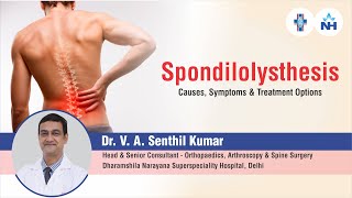 Spondylolisthesis  Causes Symptoms and Treatment Options  Dr V A Senthil Kumar [upl. by Alexine643]