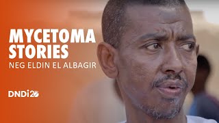 Mycetoma stories Neg Eldin El Albagir [upl. by Nicholas]