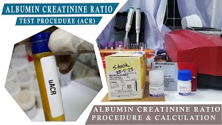 ALBUMIN CREATININE RATION ACR How to Microalbumin Test amp Urine Creatinine Test Procedure [upl. by Feeley526]