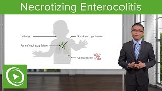 Necrotizing Enterocolitis – Surgery  Lecturio [upl. by Avera]