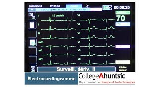 Le coeur Lélectrocardiogramme ECG [upl. by Mavilia703]