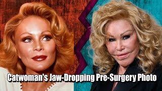 Catwoman Jocelyn Wildensteins Stunning PreSurgery Look Revealed [upl. by Arramahs]