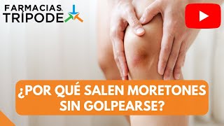 ¿Por qué salen moretones sin golpearse [upl. by Danni]