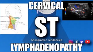 Sonoquickies  Cervical Lymphadenopathy [upl. by Grigson]