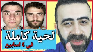 اكتشفت اقوي علاج متكامل علي كوكب الارض 🌍 لانبات شعر اللحية بالكامل في ٤ اسابيع How To Grow a Beard [upl. by Swithin]