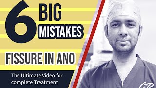 6 BIGGEST MISTAKES in FISSURE  Watch complete video for best results for pain in Fissure Treatment [upl. by Ahsie]