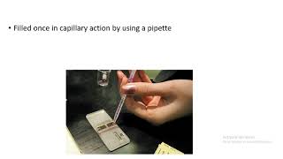 Manual platelet count [upl. by Ilenay]