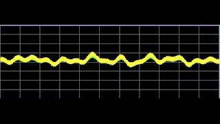 Hypothyroid  Rife Frequencies [upl. by Hodosh229]