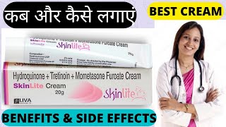 Decdan Lite Cream Skin Doctor Recommended सबसे अच्छी क्रीम PharmaMedicine [upl. by Ayatnohs]