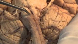 The Visual Pathway Neuroanatomy Video Lab  Brain Dissections [upl. by Whitman446]