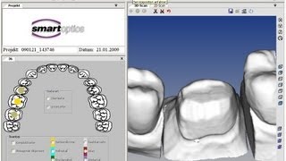 CAD CAM Dental Scanner Streifenlichtscanner Teeth cnc 4  5 axis Achsen Zirkon machining bridge [upl. by Elolcin374]