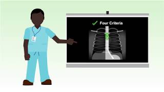 How to Place a Nasogastric NG Feeding Tube [upl. by Inittirb]