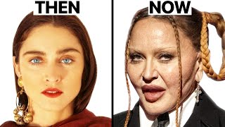 Madonna Plastic Surgeries  Surgeon Reacts [upl. by Grant]