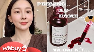 PEELING THE ORDINARY 30 AHA AT HOME   ePharmacy [upl. by Epilif138]