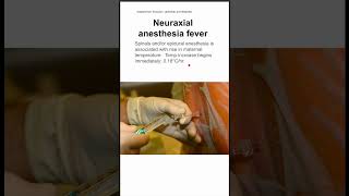 Neuraxial anesthesia fever [upl. by Nosirb]