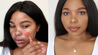 HOW TO COVER HYPERPIGMENTATION AND DARK SPOTS ON BROWN SKIN [upl. by Vladamar202]