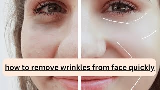 How to remove wrinkles from face quickly [upl. by Subir851]